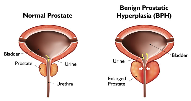 health prostate illustration 